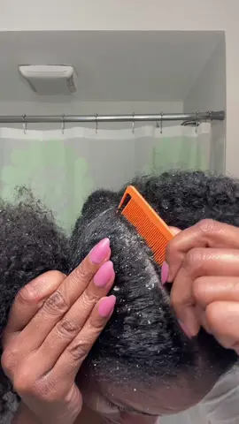 PART 3!!!  Lorddddd i gotta release this stress so my scalp can get better! #sebboricdermatitis #sebborheicdermatitis #fyp #dandruff #dandruffremovel #scratching #asmr #washday #