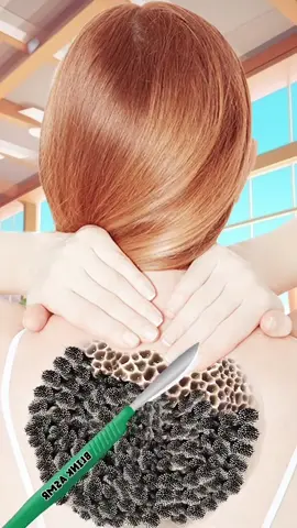 ASMR cleaning dirt, maggots and dogticks from girls foot, hand and back #asmr #cleaning #calmcareclinic #animation #dogticks #girlproblems #trendingtiktok 