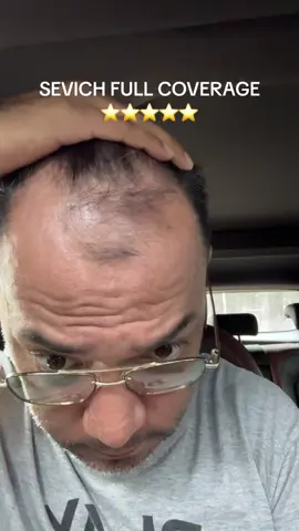 Pantapal sa napapanot na ulo 🫣 🤩@Sevich_PH @SEVICH #sevich #affiliatemarketing #hairshadow 