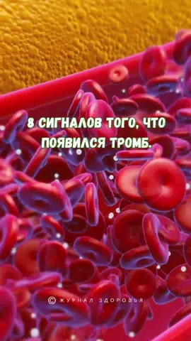 8 сигналов того, что появился тромб? Как наше тело посылает нам предупреждения. #тромб #тромбоз #атеросклероз #здоровье #здоровьебезлекарств #советыпоздоровью #журналздоровья 