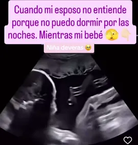 Y asi dicen aprovecha a dormir ahorita 😆😆 #fypシ゚viral #fypage #babygril💖😍 #esperandobebe🤰🏻🥰 #miniña2 
