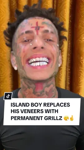 Island Boy Replaces His Veneers with Permanent Diamond Grillz 🌴👯💎@Flyysoulja #islandboys #grillz #jewelrytiktok #fypage 
