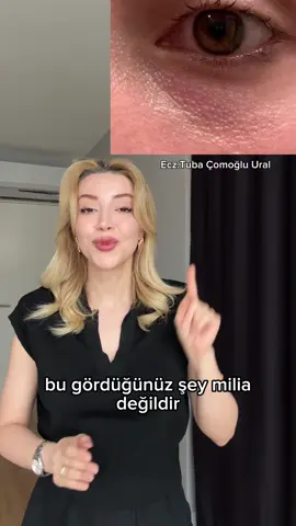 Milia videomu izlemediyseniz ona da bakabilirsiniz❤️ Retinol her göz çevresine uygun olmayabilir, lütfen doktorunuza veya eczacınıza danışın