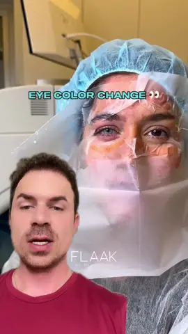 Teria coragem de mudar a cor dos seus olhos? #cor #olhos #transformacao #fy #fyp 