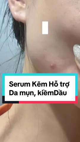 Ekseption Serum ZnPCA 2% XS Hyaluronic Acid và 1% Zinc PCA hỗ trợ da mụn, kiềm dầu #ekseption #serumdamun #trimun #chuamun #thunholochanlong #acnetreatment 