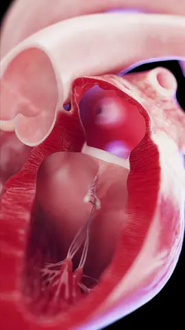 💓 Heart Health 101: Tricuspid & Mitral Valves 💓 What are these valves, and why are they so important? Dive into a quick lesson on how they keep your heart pumping strong! Music by @alexpfefferco  #HeartHealth #LearnWithSciePro #EduTikTok #Science #3d #cardio #physio #heart #med #meded #sciart #medart #vray #animation #rendering #autodesk #3dsmax #zbrush #health #medstudent #anatomyart #cardiac