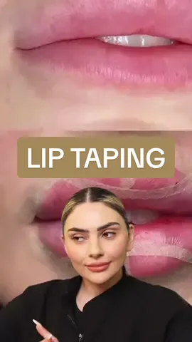 We need to BFFR about lip taping y’all 🤦🏻‍♀️👄 In what universe will gravity NOT defy that tape🤣 What’s being held up WILL come down. Sorry! #liptaping #lipmigration #liptapingtechnique #aestheticinjector #thestepanyanclinic #TSC #fakebotox 