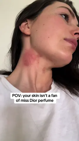 What is in it @Diorbeauty acid? 😭😭🥹 this is my end of praying different perfumes at the airport… #allergicreaction #allergins #sensitiveskin 