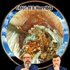 #ear #earwax #earwaxremoval #earwaxcleaning #satisfying #fyp 