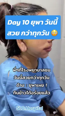 วันนี้สวยกว่าทุกวัน @ยุพา คนสวย #รีวิวหมอเฟบSLC #รีวิวหมอเต้SLC #รีวิวหมอปลาวาฬSLC #รีวิวหมอซายน์slc #รีวิวศัลยกรรมSLC #รีวิวเสริมจมูกโอเพ่นSLC #รีวิวศัลยกรรมSLC #รีวิวเสริมจมูกโอเพ่นSLC #ดึงหน้าย้อนวัยSLC #รีวิวเสริมจมูกSLC #หมอปลาวาฬslc #รีวิวเสริมจมูกปรับโครงสร้าง #น้องยุพาคนสวย #หน้าแก่ก่อนวัยทําไงดี #หน้าแก่ก่อนวัย #โรคหน้าแก่ก่อนวัย #หน้าแก่ #คนไทยชอบบูลลี่ #ดราม่าวันนี้ #ดราม่า #สาวหน้าแก่ #น้องยุพา #ยุพา #ยุพาปัจจุบัน #ยุพาคนสวย #หน้าใหม่ #หน้าใหม่ยุพา #slchospital #slc #รีวิวslc #รีวิวslchospital #ติดตามตอนต่อไปค่ะ 