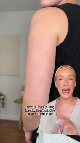 wave goodbye 👋 to keratosis pilaris with our NEW glycolic acid body stick 💪 @Kyndall Ames #theinkeylist #glycolicacid #strawberryskin #keratosispilaris 