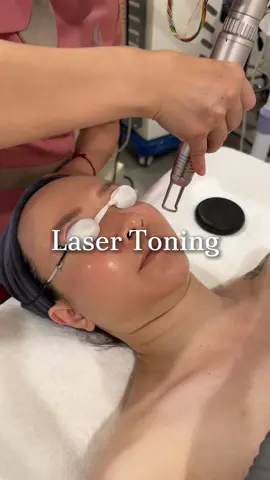 Laser Toning - phương pháp làm đẹp an toàn, hiện đại, không cần nghỉ dưỡng Da cổ là nơi mà các chị em sau 30 tuổi lo ngại nhất vì khó chăm sóc như da mặt. Nhiều khi các nàng còn bỏ qua bước chăm sóc da cổ vì nghĩ không quan trọng. Nhưng mà để mà đoán tuổi một người thì người ta hay nhìn vào da tay, da cổ đó nha🙂‍↔️ Laser Toning cũng là phương pháp sử dụng các chùm tia laser tác động vào các lớp da ở tầng thượng bì và trung bì nhằm loại bỏ các khuyết điểm do lão hoá, làm mờ các vết nhăn cũng như thâm mụn, các hạt nhiễm sắc tố. Hiện tại LiLiA đang có chương trình siêu ưu đãi cho các nàng iu chỉ còn 499.000vnđ mà giá gốc 1.500.000vnđ lận 🥲 đã quá pepsi ơi Nhắn tin cho chúng mình để được tư vấn thêm nha! 