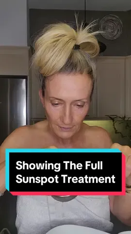 Showing you the FULL secret to removing SUN SPOTS! ❤️ #antiagingskincare #sunspots #brownspots #naturalskincare #holisticskincare #over50women #beautyover40 