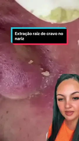 Extração de milhoes #cravos #limpezasatisfatoria #reagindo 