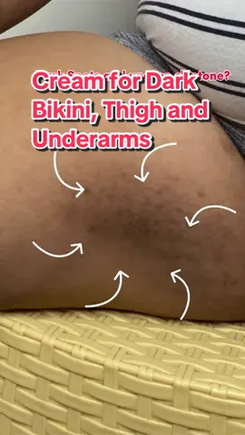 Must try! Clarity Essentials Inguinal Whitening Cream for Dark Underarms, Thigh and Bikini area ❤️ #inguinalwhiteningcream #clarityessentialsinguinalwhiteningcream #clarityessentials #bodycare #whitening #skincare #whiteningcream 