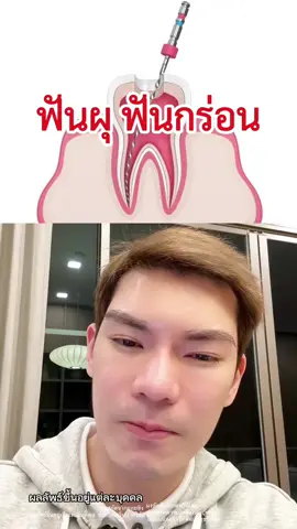 ฟันผุฟันกร่อน ลองเปิดใจใช้ยาสีฟันขิงขิง มีฟลูออไรด์สูงสุด ช่วยป้องกันฟันผุได้ดี แนะนำเลย #ยาสีฟันขิงขิง #ยาสีฟันสมุนไพร #ยาสีฟันบอสหนุ่ม #ฟันเหลือง #ฟันขาว #จัดฟัน #ลดกลิ่นปาก 