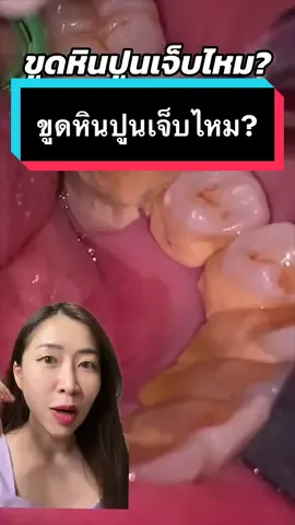 ตอบกลับ @usernxskm7c8y1 ขูดหินปูนเจ็บไหม? #หมอณัฐคุณ #คลินิกทันตกรรมทูธลักค์ #toothluck #ทําฟันขอนแก่น #ทําฟันmrtแยกติวานนท์ #ขูดหินปูน #tiktokสายความรู้ #รักสุขภาพ #รู้จากtiktok #tiktokuni #กรีนสกรีนวิดีโอ #กรีนสกรีน 