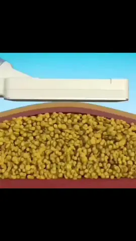 A criolipolise pode se dizer que é uma lipo sem corte.É a solução para a gordura localizada...Diga adeus para suas gordurinhas...