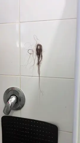 How did i know i had a thyroid problem? Hairloss. This has been gradually getting worse over the last 6 months. All the pictures and videos are from today and only show from my morning brush. I shampooed, conditioned, ran the conditioner through and let it sit for 5 minutes, when i rinsed - the first picture is what came out. Then i dried and brushed it, the brush was full and the floor was covered. My hairline is starting to go patchy and it happens every single time i brush my hair. When i went to the doctor i was told i was worried about nothing and i was just low on vitamin B12. I knew there was something more going on, and it was the hairloss that was a tell tale sign. They said it should thicken out again eventually but it feels like it just goes so fast, im so scared to end up bald or super patchy😂 any tips are welcome to help thicken it out again and maybe reduce the hairloss! #hairloss #hairlosssolutions #hair #hairtok #thyroid #thyroidproblems #medical #fyp #alternativemedicine #naturalhair 