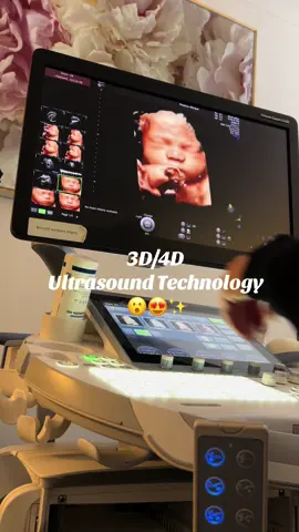 Some of our favourite 3D/4D ultrasounds of the month so far 🙊😍 Equipped with the latest ultrasound technology, these scans capture a sneak peak of your gorgeous little one! DM, call or email us to book 🩷✨ #preciousglimpse #3d4dultrasound #preciousglimpsemelb #ultrasound #melbourne #ultrasoundtech #ultrasoundlife 
