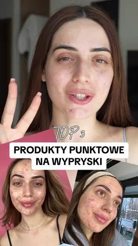 Rozpoznajecie któreś ze swojej kosmetyczki? Wymienione w filmie produkty to: • Bioderma Sebium Kerato+ • Erborian Centella SOS Patch • Kiehls Blemished SkinTruly Targeted Blemish Clearing Solution Buziaki 🤍 #niedoskonałości #przebarwieniapotradzikowe 