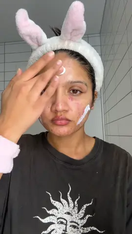 Night time skincare routine. Dr. Suggest me not to use Adapalene while on isotretinoin.  #acne #acnetreatment #skincare #skincareroutine #acnemakeup #acnemarks #acneskin #acnescars #acnefighter #acneproneskin #acnepositivity #acneskincare #acneskincareroutine 
