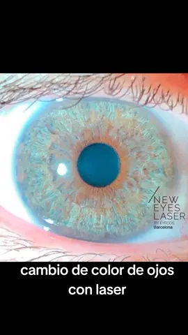 Cambio de color de ojos por laser #fashionista 
