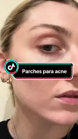 Los beneficios de parches para la acne 🫀#tiktokshop #tiktok #tiktokstore #tiendadetiktok #tiendadetiktokviral #espinillas #acne #acnetreatment #acneskincare #acnetips #mujeres #hombres #pimple #pimples #pimplepatch #qustere #qusterepimplepatch 