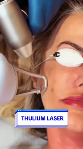 Você já ouviu falar do Thulium Laser? ✨ Este é um avançado aparelho projetado para aprimorar a textura da pele e proporcionar um brilho natural. 🤩 O Thulium Laser age especificamente na camada mais superficial da pele, a epiderme, onde atua para reduzir rugas superficiais e clarear manchas, promovendo resultados visíveis e duradouros.  Sua eficácia está na capacidade de tratar a epiderme com precisão, conferindo à pele um brilho seco e saudável, conhecido como 