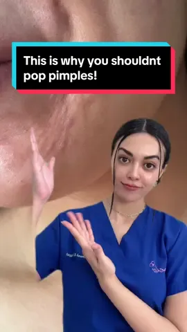 Popping pimples damages collagen, causes skin trauma, increases inflammation, leads to scarring, and can result in premature wrinkles and uneven skin texture. It also risks infection and prolonged healing. #acne #oilyskin #pimples #blackhead #wrinkles #aging #skincare #acnetreatment #acnescars #acnetips #foryou #foryoupage #fyp 