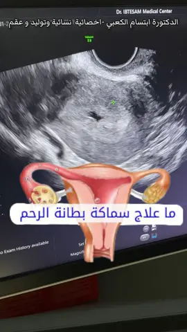 ‏‎#here_is_how #حياه_بصحه# #infoburst# #fypシ #foryou #fyp #viral #viralreels #دكتورة_ابتسام_الكعبي #دكتورة_ابتسام_الكعبي_مركز_ابتسام_الكعبي  #العراق #الامارات #uae #trending #trend #تعلم_على_التيك_توك #تعلم #LearnOnTikTok #learn #tipsandtrick #طبيب_تيك_توك  #Howto  #خطوات_على_تيك_توك #foryou  #explorer  ‎ #هرمونات  #حمل  #حمل_وولادة #نساء #نسائية_وتوليد  #نساء_وولاده #عقم  #لحميه ‎#لحمية_الرحم #like #follow #share #tiktok #info #tik 