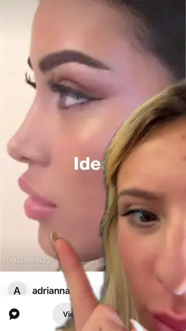 Obsessed #fyp #mexico #nosejob 