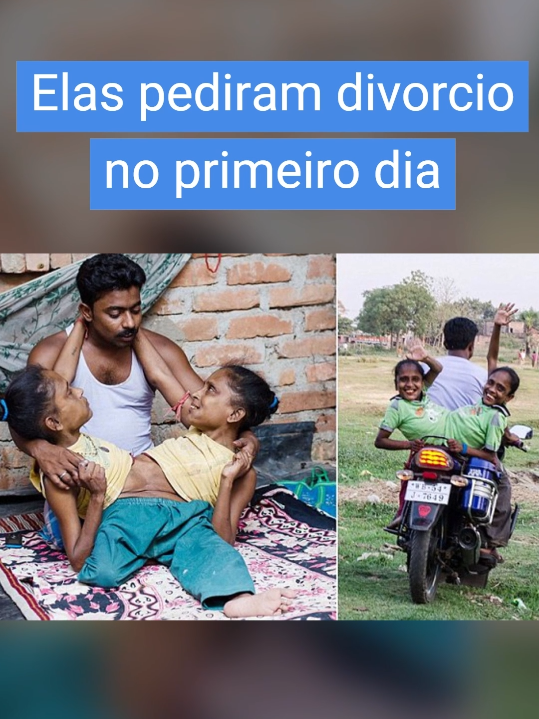 Ele se casou com essas irmãs siamesas, mas depois que elas descobriram o que ele queria fazer com elas, pediram o cancelamento do casamento. #casamentos #historias #fatos #superaçao