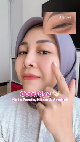 Alhamdulillah ga mata pandaan lagi 🐼 #eyepatch #eyepatches #maskermata #lanbena #eyemask #eyeserum #eyecream #matapanda #kantungmata  #eyepatch #lanbenaeyepatches #darkcircle #pandaeyes #racuntiktok #racunskincare #foryoupage #belanjaditiktoklagi #reviewjujur 