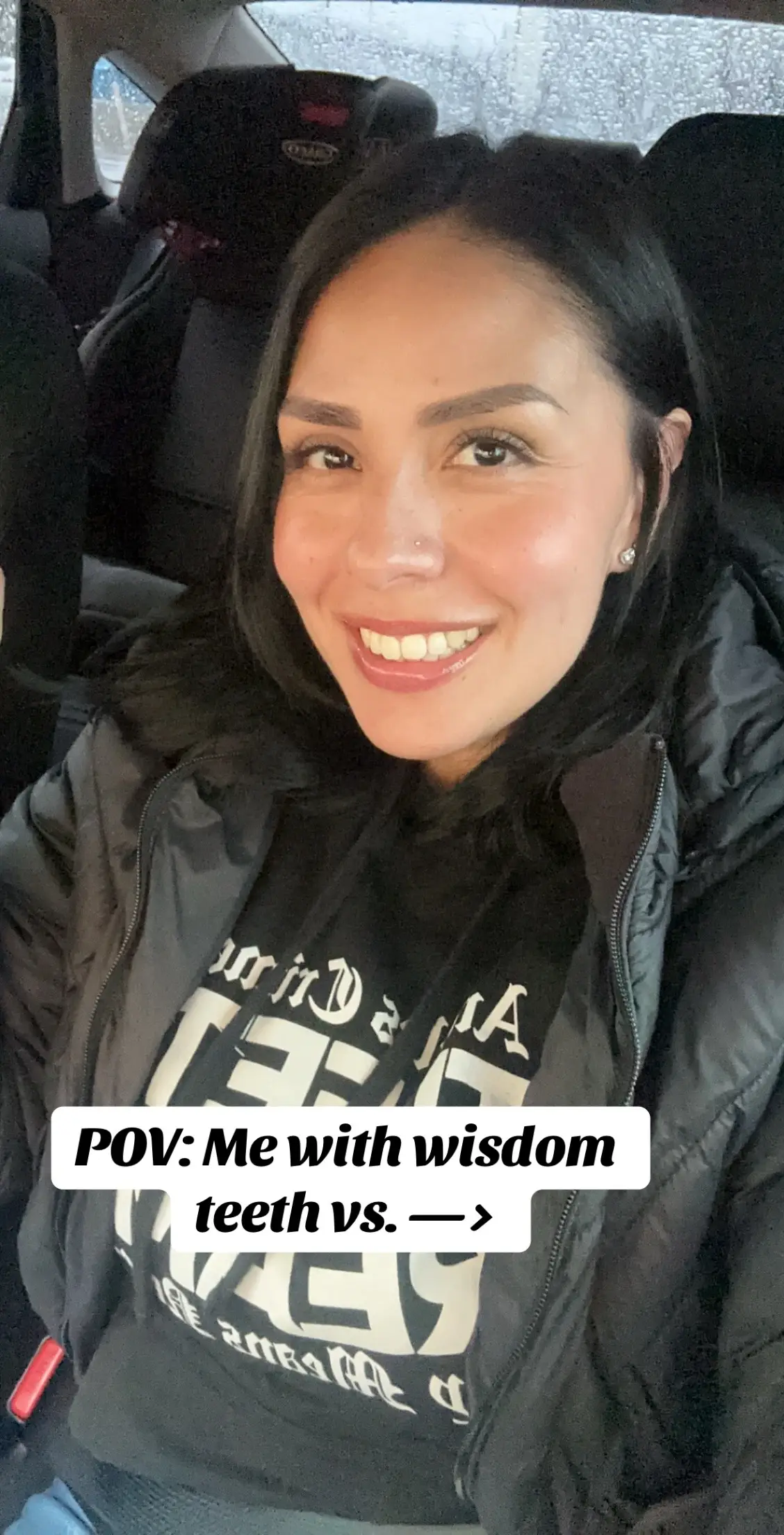 Removing all 4 wisdom teeth is no joke 😫 #Wisdomteeth #Foryoupage #Brothereww 