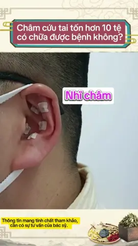 Phương pháp Nhĩ Châm được BS.Tống Phong Phó trưởng Khoa Phục hồi chức năng Bệnh viện Y học cổ truyền Trung Quốc Tây An chia sẻ. #yhoccotruyen #yhoccotruyenvietnam #yhct #đôngdượcviệt 
