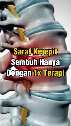 KELUHAN SARAF KEJEPIT, BIIDZNILLAH SEMBUH 1X TERAPI ✨️ Jadi cerita nya Kami kedatangan Klien, seorang Bapak yang mengalami keluhan sakit Leher yang terasa ketarik sampai ke Belikat, yang sudah beliau alami selama 1 bulan lamanya. Kemudian kita bantu cek untuk mengetahui bagian titik mana saja yang mengalami pelintiran, sebelum adanya tindakan terapi. Lalu kita ikhtiarkan dengan terapi Metode PAZ Al-Kasaw, kita kasih beberapa gerakan untuk mengurai pelintirannya, dan Alhamdulillah biidznillah.. dengan izin Allah, kini keluhannya Rilis, beliau sudah merasa nyaman kembali dan kini bisa beraktivitas secara normal. Nah maka bagi Bapak Ibu sekalian yang kini sedang mengalami keluhan yang sama, namun bingung ingin berobat kemana, silahkan ikhtiarkan langsung ke Griya Sehat Mumtaza Healthy, Insyaa Allah kita akan bantu ikhtiarkan untuk keluhan yang dirasakan oleh Bapak Ibu sekalian. Barakallahufiikum.. Barokallaahu fiikum.. ------------------------------------- .  . . #sarafkejepitleher #sarafkejepit #pazalkasaw #paz #mumtazahealthy 