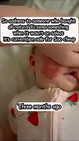 You should definitely try this if your baby has eczema #makeup #skincare 