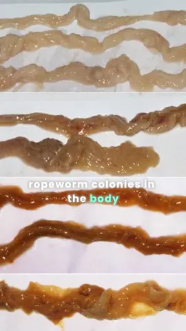 Ropeworm is gross #ropeworm #parasites #gross #naturopathy #facts
