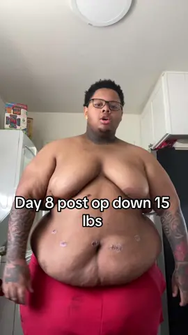 Feel way better freling great big back gang #vsg #bariatricsurgery #bariatric #wls #postop 