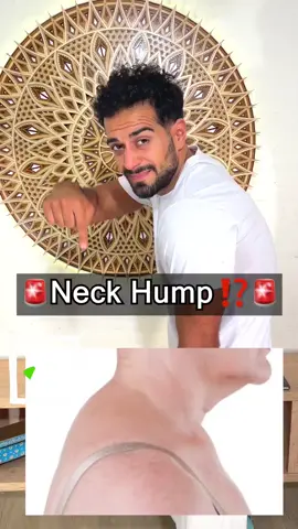 As always, feeling a crack can be nice but it is not necessary to experience the benefits of this exercise. Simply hold 3x for 30 seconds and enjoy 😊 #neckhump #posture #posturecorrectiontips 