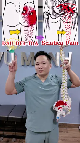 Giải toả đau dây thần kinh toạ tại nhà 🤔 #viral #vumanhyhoccotruyen #sciaticapain 