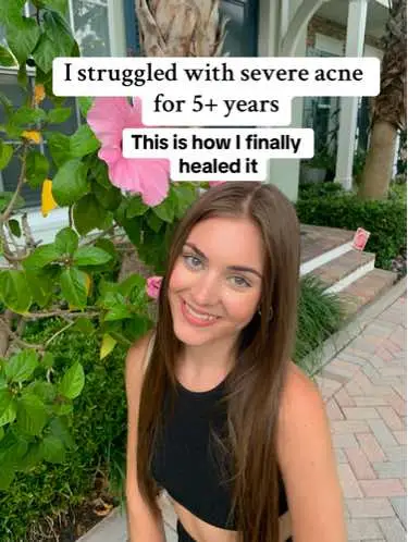 A year ago I would have never showed these photos to anyone but I want to share my story using this platform in hopes that I can help others who are struggling just like I was🩷 comment below if you have any questions!! #acne #acnetoclearskin #acneadvice #acneskin #acnetips #acneproneskin #skin #skincare #skincareroutine #skincaretips #healing #HealingJourney #skinhealth #fy #fypage #fypシ゚viral #discover #fyy #foryoupage #foryou #fyppppppppppppppppppppppp  @Face Reality 