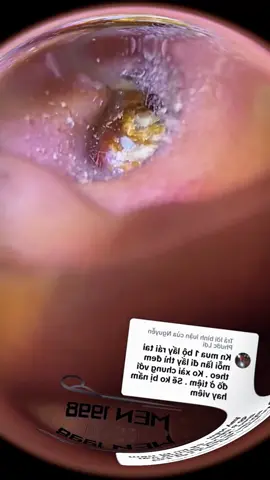 relax #ear #earwax #earwaxremoval #chill 