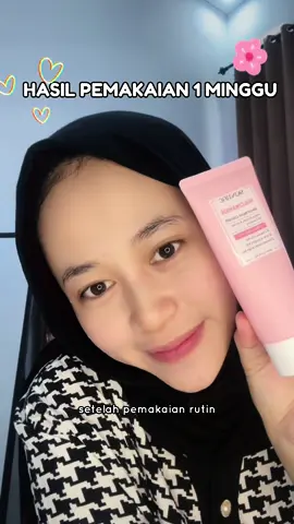 SKINTIFIC Niacinamide Brightening Facial Cleanser Gentle Glowing Sabun Wajah bikin cerah dalam 1kali pakai, ini hasil pemakaian satu minggu #skintificniacinamidebrightening #skintificniacinamidebrighteningcleanser #skintificniacinamide #cleanser #skintificcleanser #skincare #skincareroutine 