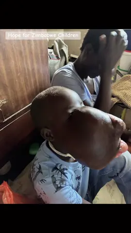 To help feel free to check Go fund me on bio profile or ecocash.Thank you for your kindness. February 2024 photos - Simbarashe Dande side view. For those asking how he sleeps. He sleeps on the other side. Seeking funds for second surgery for tumour stricken 9 year old Simbarashe Dande  27 May 2024 Simbarashe, a  9 year old boy from rural Murehwa, Zimbabwe, grapples with maxillofacial osteosarcoma , a tumour that has engulfed his mouth and nostril, leaving him in constant agony.  His father passed away in 2019, shortly after Simbarashe ‘s first surgery in South Africa aimed at combating the aggressive tumour.  Simbarashe's mother, Maria, struggles to make ends meet as she tends to her son's needs. The relentless growth of the tumour has distorted Simbarashe's face, nose, and eye, hindering his ability to speak, eat well and breathe. In 2019, Hope for Zimbabwe Children facilitated Simbarashe's journey to South Africa for surgery, but despite the removal of a portion of the tumour, the operation proved unsuccessful. He therefore needs second surgery. He currently uses a tracheostomy which aids him in breathing. We are urgently seeking financial assistance to fund Simbarashe's second surgery, preferably in a developed nation or any facility capable of providing the necessary medical care.  You help will be greatly appreciated. #CapCut #hopeforzimbabwechildren #simbarashedande #tumour #childrenhealth #cancerinchildren #motivationalvideo #motivationalquotes #motivationalspeech #worshipmusic #churchsongs #borndifferent #uktiktok #uktiktokers#ukdonors #ukphilanthropists #helpforchildren #zimbabwechildren #tiktokzimbabwe #tiktokusa #hopeforchildren #amazingchild #healthyliving #goviralontiktok #tiktokviralvideos #fyp #fypviral #foryourpage #creatorsearchinsights #prayerwarriors #africatiktokers #southafricatiktokers#ilovetiktok #charitywork #charityshop #breakingnews #worldnews #orphans#godisgood #thankyou