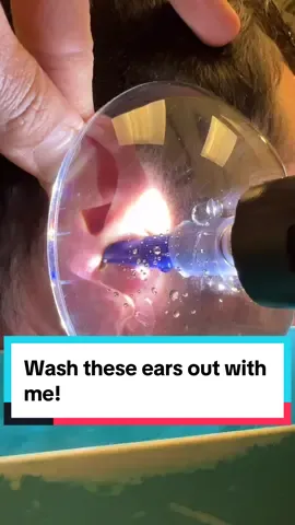 🚿 👂 Wash these waxy ears out with me using the @earigator  #earcleaning #earwax #waxremoval #wax #ear #audiology #audiologist #messy #shower 