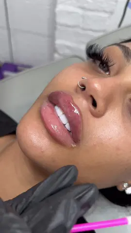 You know your works good when people steal your content to pretend it’s theirs 🙃🙃🙃 #lipfiller #russianlips #fy #fyp #lips #beauty 