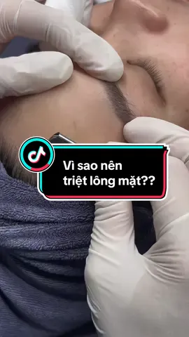 TRIỆT LÔNG MẶT – NÊN HAY KHÔNG NÊN? ⁉️ LỢI ÍCH KHI TRIỆT LÔNG MẶT: - Nhìn da sáng hơn, đồng đều màu hơn:  Màu da nhìn có được sáng sủa hay không không chỉ phụ thuộc vào sắc tố Melanin, tuần hoàn máu, mà màu lông mặt đôi khi cũng khiến da nhìn vào thấy bị loang lổ, không đều màu. - Giúp cổ nang lông (lỗ chân lông) thu nhỏ hơn:  Kích thước của lỗ chân lông không chỉ phụ thuộc vào việc tăng tiết dầu của da mà còn phụ thuộc vào kích thước của sợi lông. Gốc lông lớn thì chu vi cổ nang lông cũng sẽ lớn theo.  Vì vậy, triệt lông mặt lại đóng một vai trò rất quan trọng trong việc làm giảm bít tắc, giúp lỗ chân lông thu nhỏ hơn, da mặt khô thoáng và sạch sẽ hơn gấp đôi. - Da mịn màng đỡ sần sùi hơn: thay vì tự cạo các chị em nên sử dụng phương pháp triệt, bởi nếu chỉ cạo khi nang lông mọc sẽ gây cảm giác thô giáp, mất thẩm mỹ cho da. - Giảm tình trạng mụn trứng cá, viêm nang lông, lông mọc ngược: đặc biệt là những ai dày sừng hoặc viêm nang lông được chỉ định là nên triệt lông mặt hoặc những vùng bị viêm. - Hấp thụ lớp phấn nền tốt hơn sau khi trang điểm: Rất ít chị em biết rằng những đám lông nhấp nhô và lỗ chân lông to là “thủ phạm” khiến kem nền không thể bám vào da mặt mà tạo thành các khoảng trắng loang lổ? Đó là lý do tại sao mà hầu hết các fashionista và người nổi tiếng đều triệt lông mặt để trang điểm đẹp và lung linh hơn trước khi dự sự kiện. Triệt lông mặt sẽ giúp bạn sở hữu làn da “ăn phấn” mỗi khi trang điểm và trở thành tâm điểm của mọi bữa tiệc. - Tăng hiệu quả việc chăm sóc và điều trị da: nếu như bạn cần điều trị nám, trắng sáng... bắt buộc phải triệt lông trước rồi mới điều trị để tăng hiệu quả liệu trình trị liệu. 💕 KHI NÀO KHÔNG NÊN TRIỆT LÔNG: Triệt lông mặt có nhiều lợi ích “thần thánh” là vậy tuy nhiên các nàng cũng cần lưu ý không nên triệt lông mặt trong những trường hợp sau để việc triệt lông mặt hiệu quả nhất nha! - Tình trạng da nhiều mụn và viêm nhiễm (thứ tự điều trị sẽ như sau: điều trị mụn – triệt lông – trị thâm, trắng sáng). - Da hay bị cháy nắng hoặc có vết thương hở, vết bỏng da. - Phụ nữ đang mang thai hay gặp các vấn đề về da. Với những lợi ích không ngờ của phương pháp làm đẹp này và hoàn toàn không có rủi ro hay biến chứng sau khi triệt, các chị em đã sẵn sàng đăng ký ngay cho mình liệu trình Triệt chưa nhỉ? #triệt_lông_uy_tín #spa_triệt_lông_uytínđanphượng  #triệt_lông_vĩnh_viễn #triệt_lông_lạnh #SPAWABISABI #Dược_mỹ_phẩm_chính_hãng 