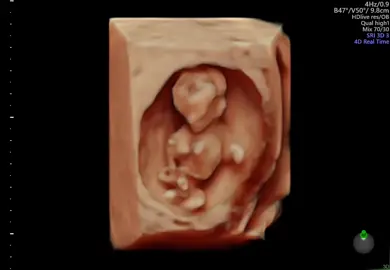 Rồng đực 12w1days 🥰. Đủ ngày đủ tháng ra với ba mẹ nha con trai 💭💭#sieuamthai #baby #xuhuong #uoclenxuhuong #embe 